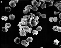Equine Red Blood Cells