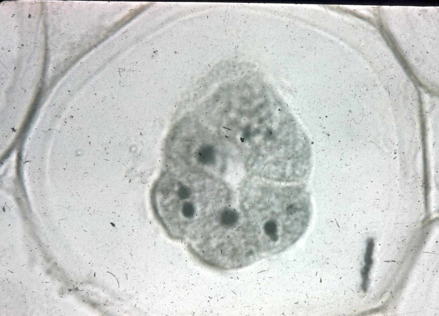 hogy néz ki a parazita toxoplazmózis